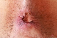 ATK hairy  in young and hairy