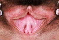 ATK hairy  in exotic and hairy