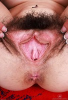 ATK hairy  in young and hairy