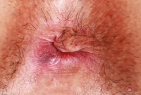 ATK hairy Amber Summer Set