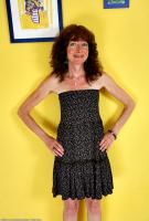 ATK hairy  in mature and hairy