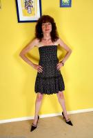 ATK hairy  in mature and hairy