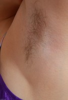 ATK hairy  in young and hairy