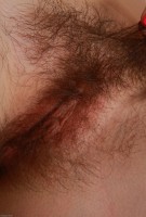 ATK hairy  in young and hairy