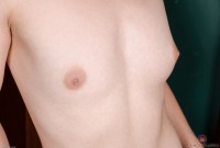 ATK hairy  in young and hairy