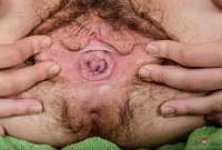 ATK hairy  in young and hairy