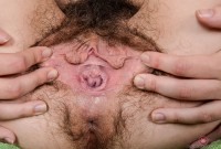 ATK hairy  in young and hairy