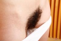 ATK hairy  in young and hairy