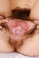 ATK hairy  in young and hairy
