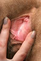 ATK hairy Anastasia Set