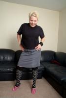 ATK hairy  in mature and hairy