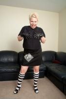 ATK hairy  in mature and hairy