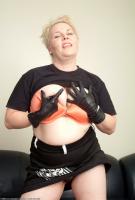 ATK hairy  in mature and hairy