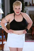 ATK hairy  in mature and hairy