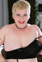 ATK hairy  in mature and hairy