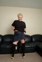 ATK hairy  in mature and hairy