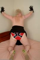ATK hairy  in mature and hairy