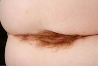 ATK hairy  in scary hairy