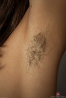 ATK hairy  in young and hairy