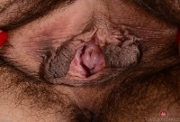 ATK hairy  in young and hairy