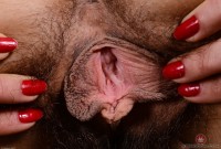 ATK hairy  in young and hairy