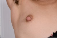ATK hairy  in young and hairy