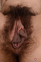 ATK hairy  in young and hairy