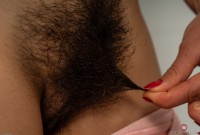ATK hairy  in young and hairy