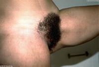 ATK hairy Angela Set