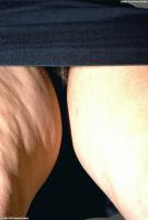 ATK hairy  in exotic and hairy