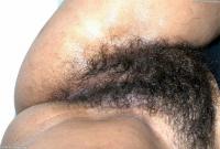 ATK hairy  in exotic and hairy