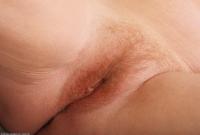 ATK hairy  in mature and hairy