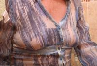 ATK hairy  in mature and hairy