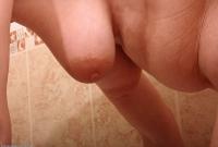 ATK hairy  in mature and hairy