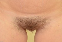 ATK hairy  in young and hairy