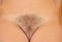 ATK hairy  in young and hairy