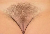 ATK hairy  in young and hairy