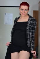 ATK hairy  in young and hairy