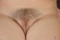 ATK hairy  in young and hairy