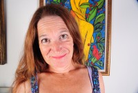 ATK hairy  in mature and hairy