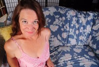 ATK hairy Anna Set