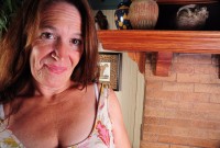 ATK hairy  in mature and hairy