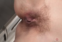 ATK hairy  in young and hairy