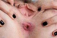 ATK hairy Apricot Pitts Set