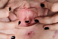 ATK hairy Apricot Pitts Set