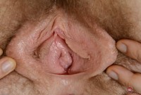 ATK hairy Apricot Pitts Set