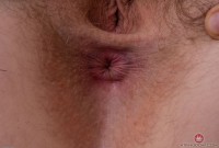 ATK hairy  in young and hairy