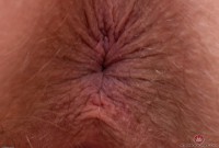 ATK hairy Apricot Pitts Set