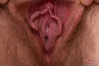 ATK hairy  in young and hairy