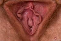 ATK hairy  in young and hairy